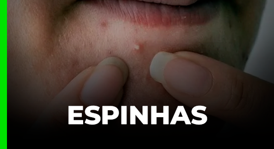 Espinhas